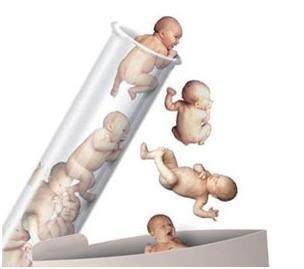 体外受精 IVF-ET
